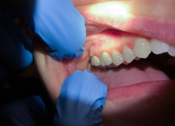 Best Emergency Denture Repair in Hesston, KS