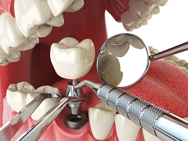 Best Dental Abscess Treatment in Hesston, KS